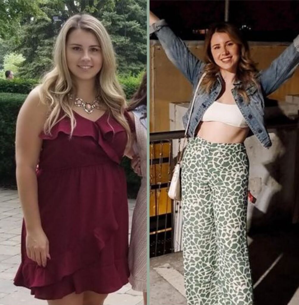 before/after